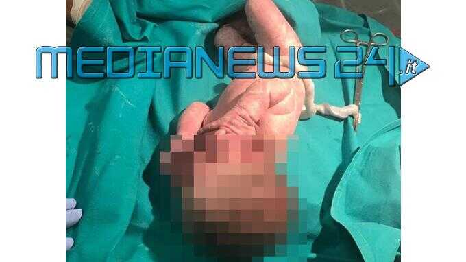 piccola-anna_nata-ischia1