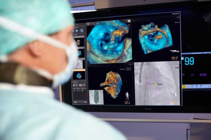 Analysis software / medical imaging / for ultrasound imaging