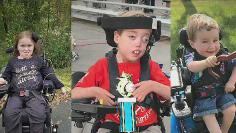 In Campania sono 80 i casi di atrofia muscolare spinale (SMA) di cui in prevalenza bambini