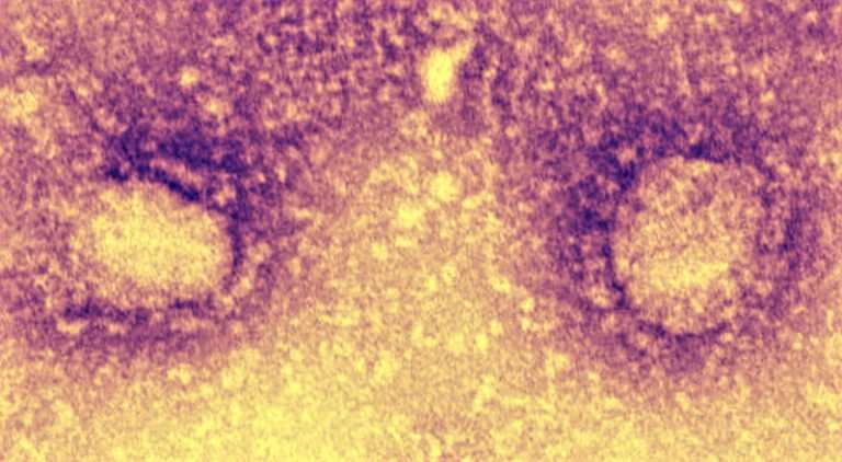 Coronavirus, isolato al virus