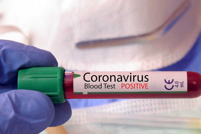 Covid-19 – Polla / Letino, due storie simili ai tempi del Coronavirus