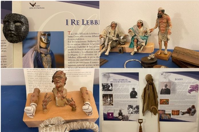 Epidemie e Vaccini. La storia in una mostra al Museo delle Arti Sanitarie