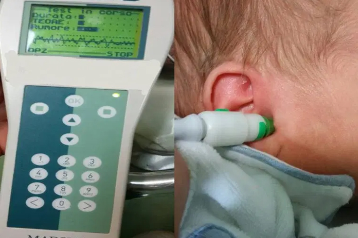 Screening Audiologico Neonatale