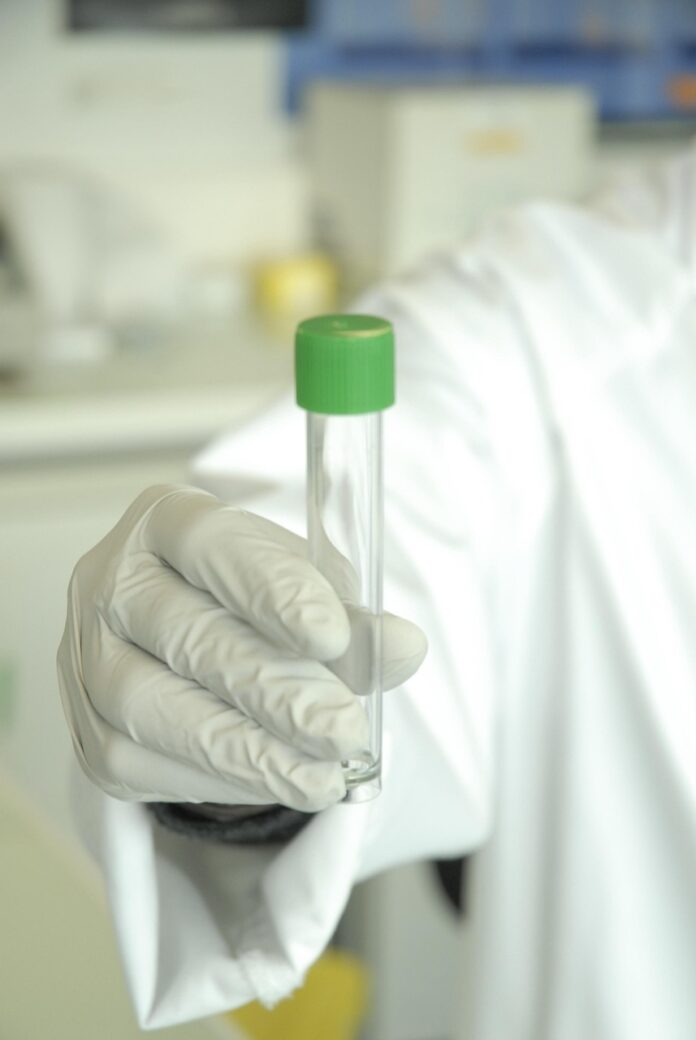 Dna di Andrea Sempio